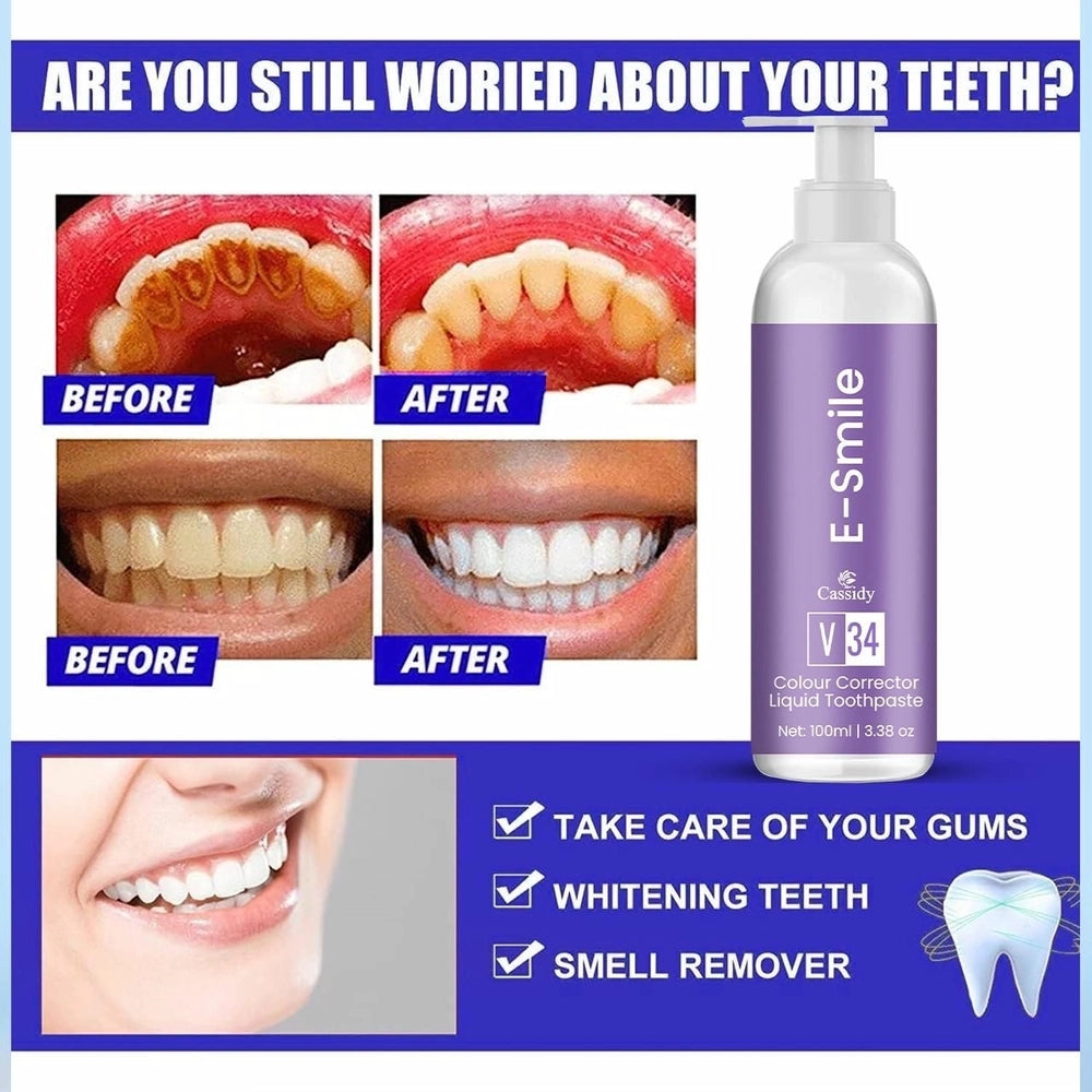 E-Smile Whitening Toothpaste