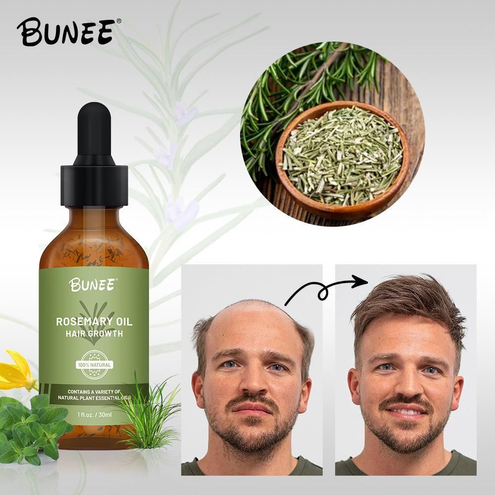 Rosemary Hair Growth Serum 30ml