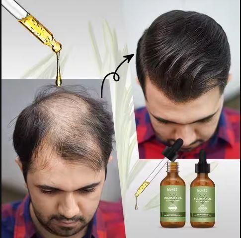 Rosemary Hair Growth Serum 30ml