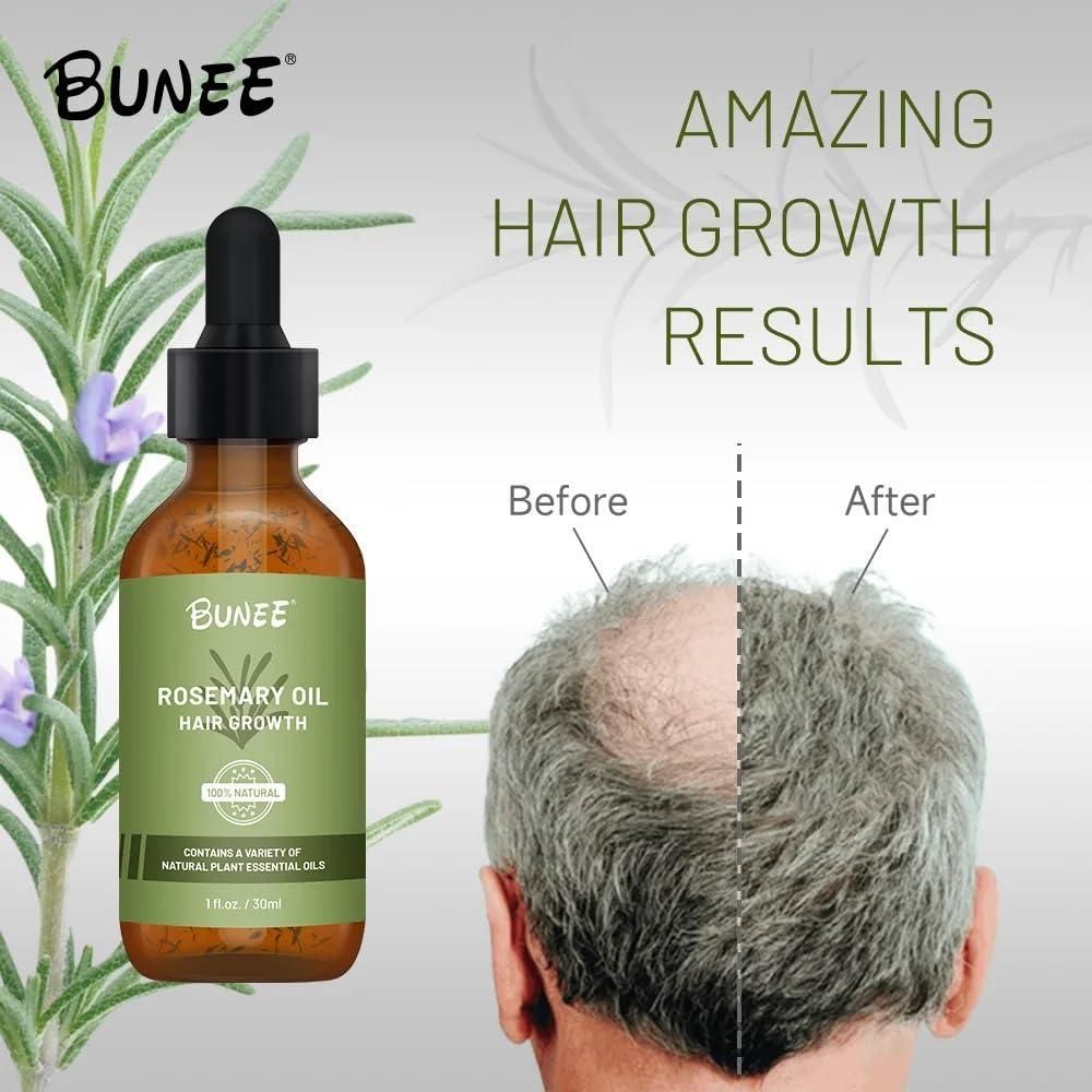 Rosemary Hair Growth Serum 30ml