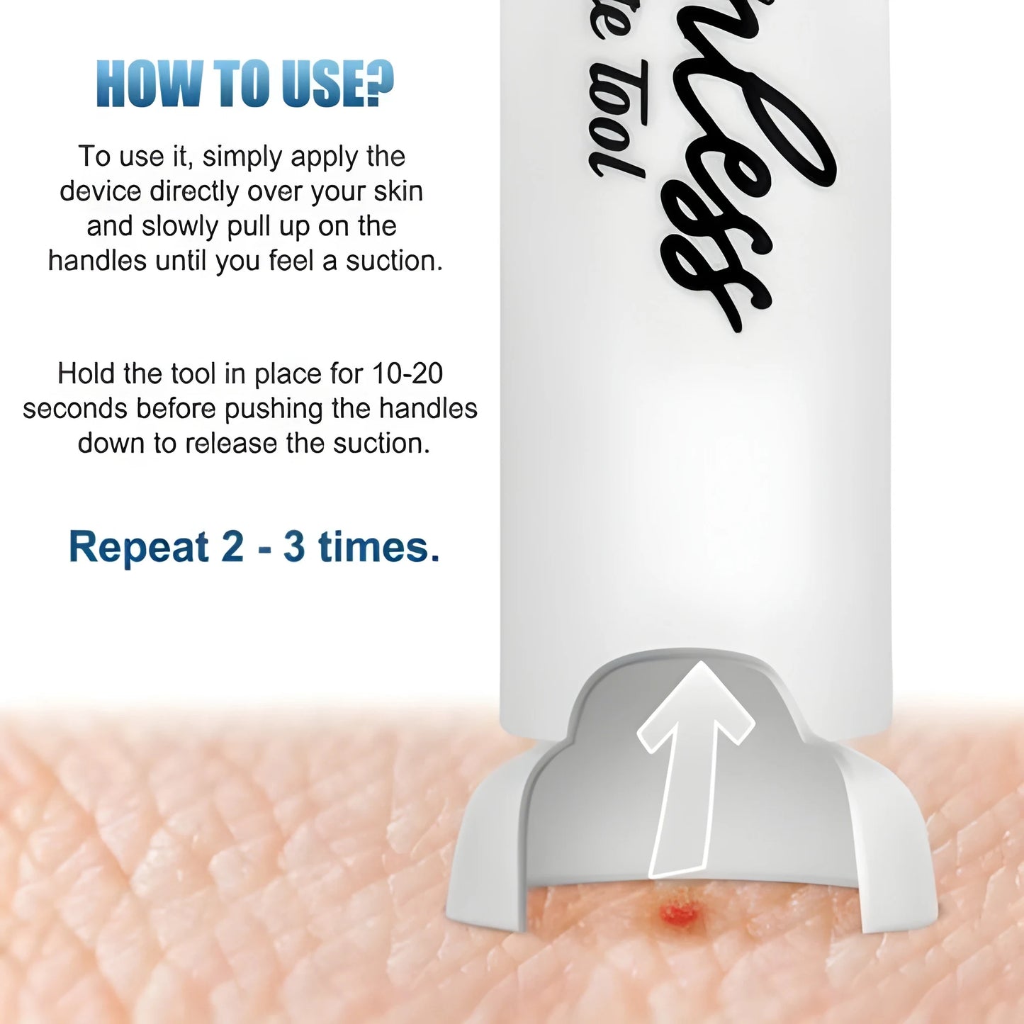 Bug Bite Emergency Relief