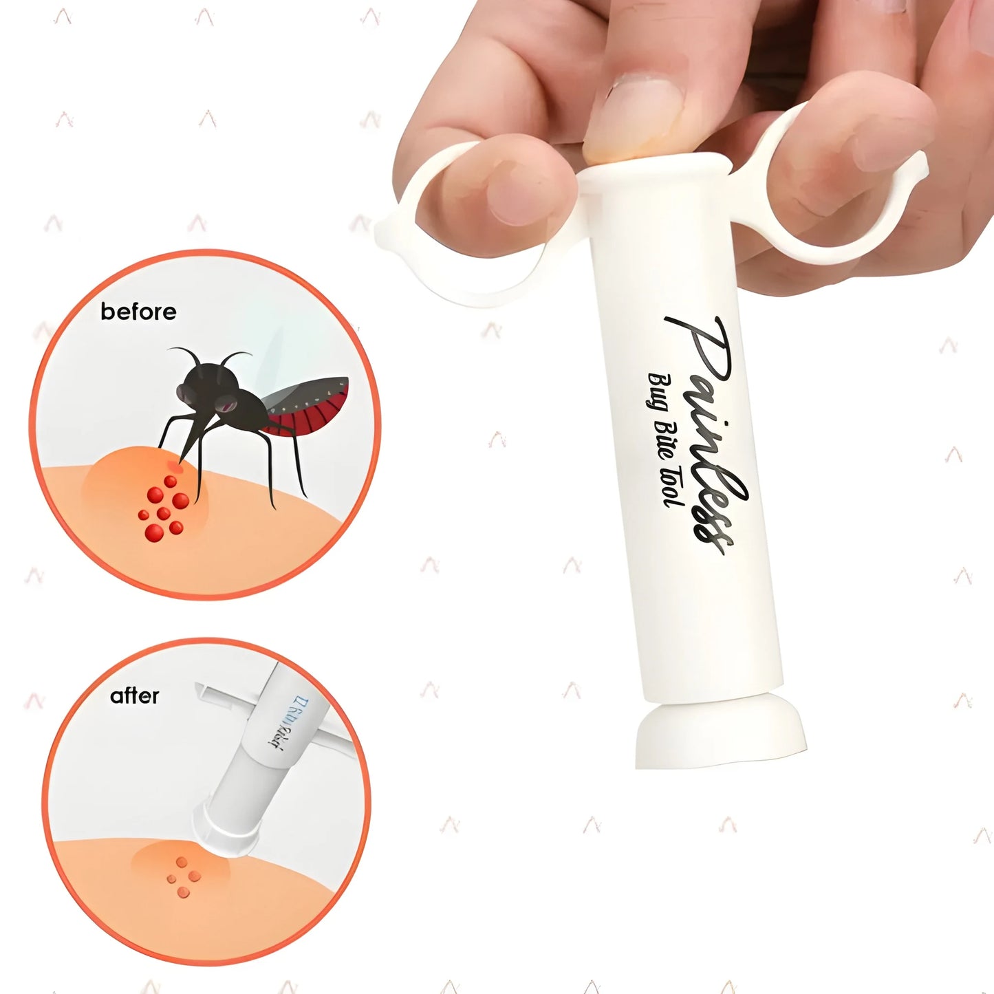 Bug Bite Emergency Relief