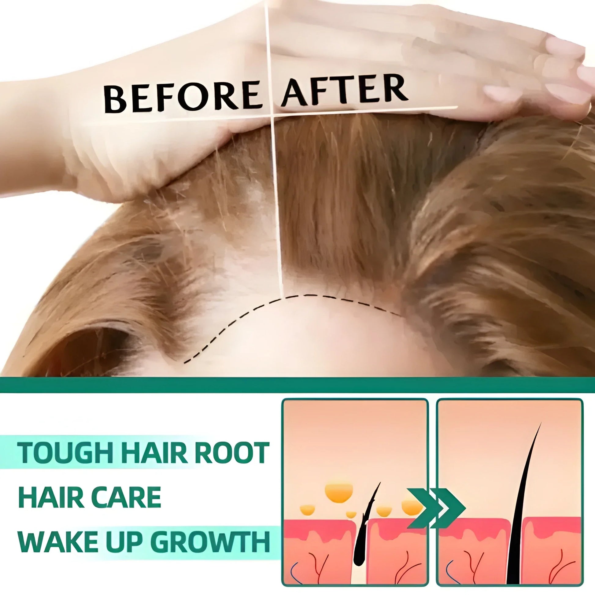 Anti Hair Loss Essence