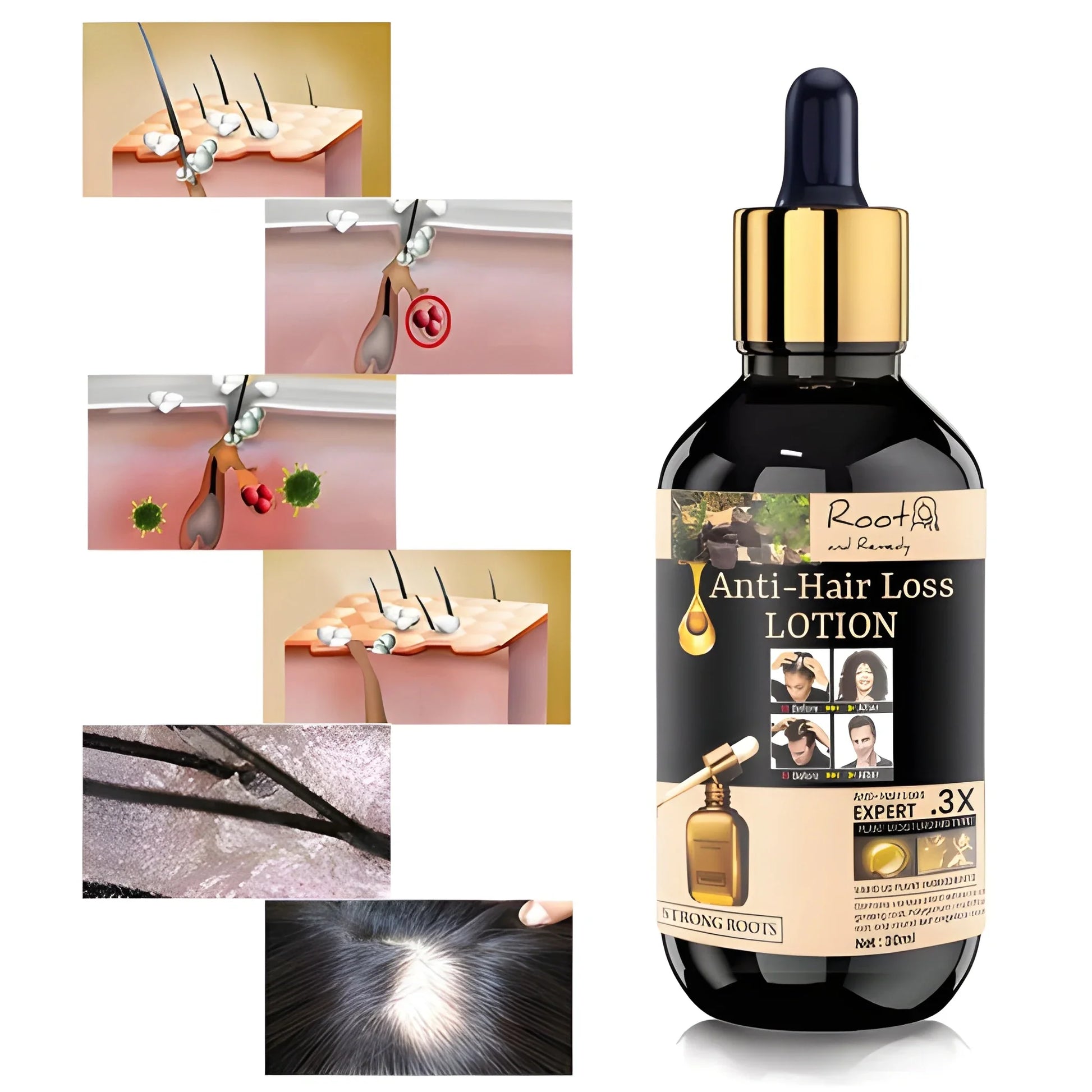 Anti Hair Loss Growth Serum