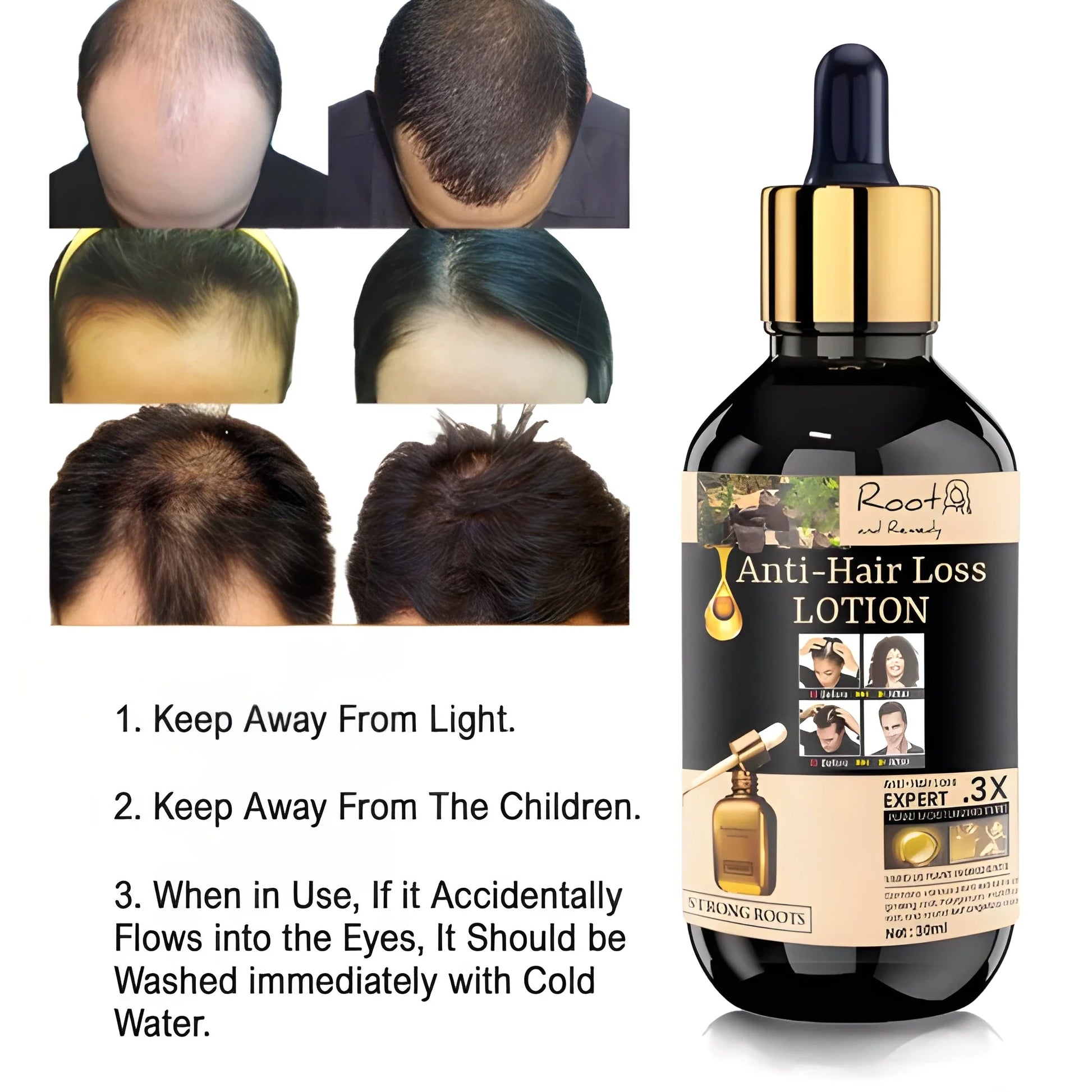 Anti Hair Loss Growth Serum