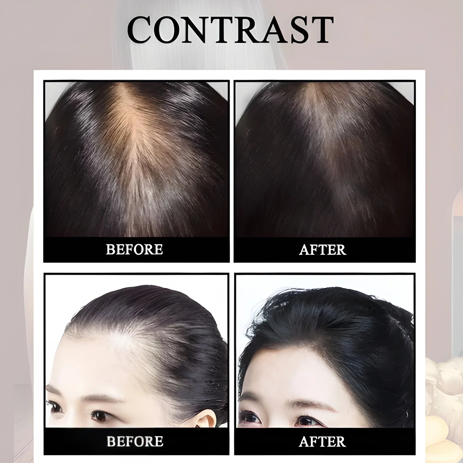 Anti Hair Loss Growth Spray