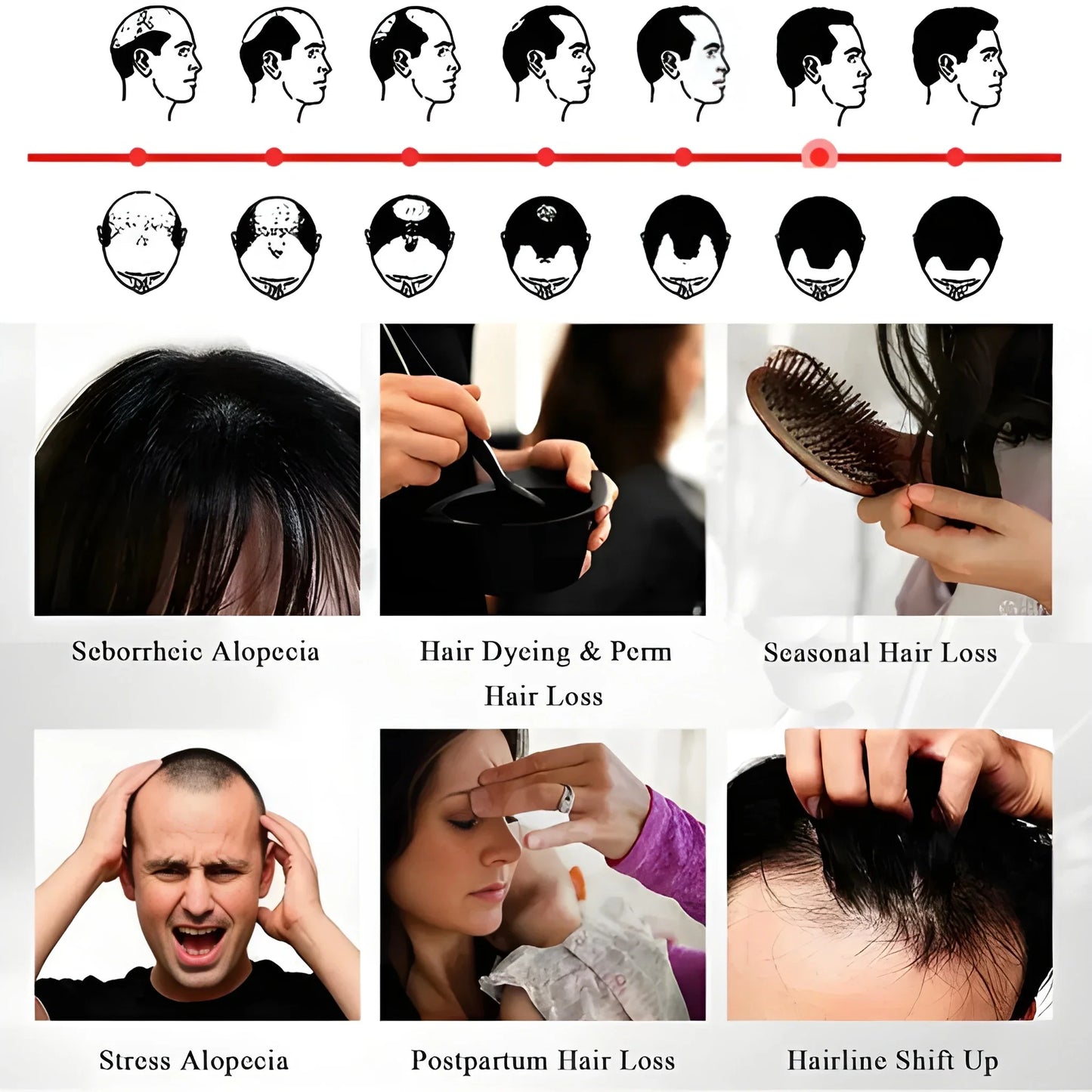 Anti Hair Loss Growth Spray