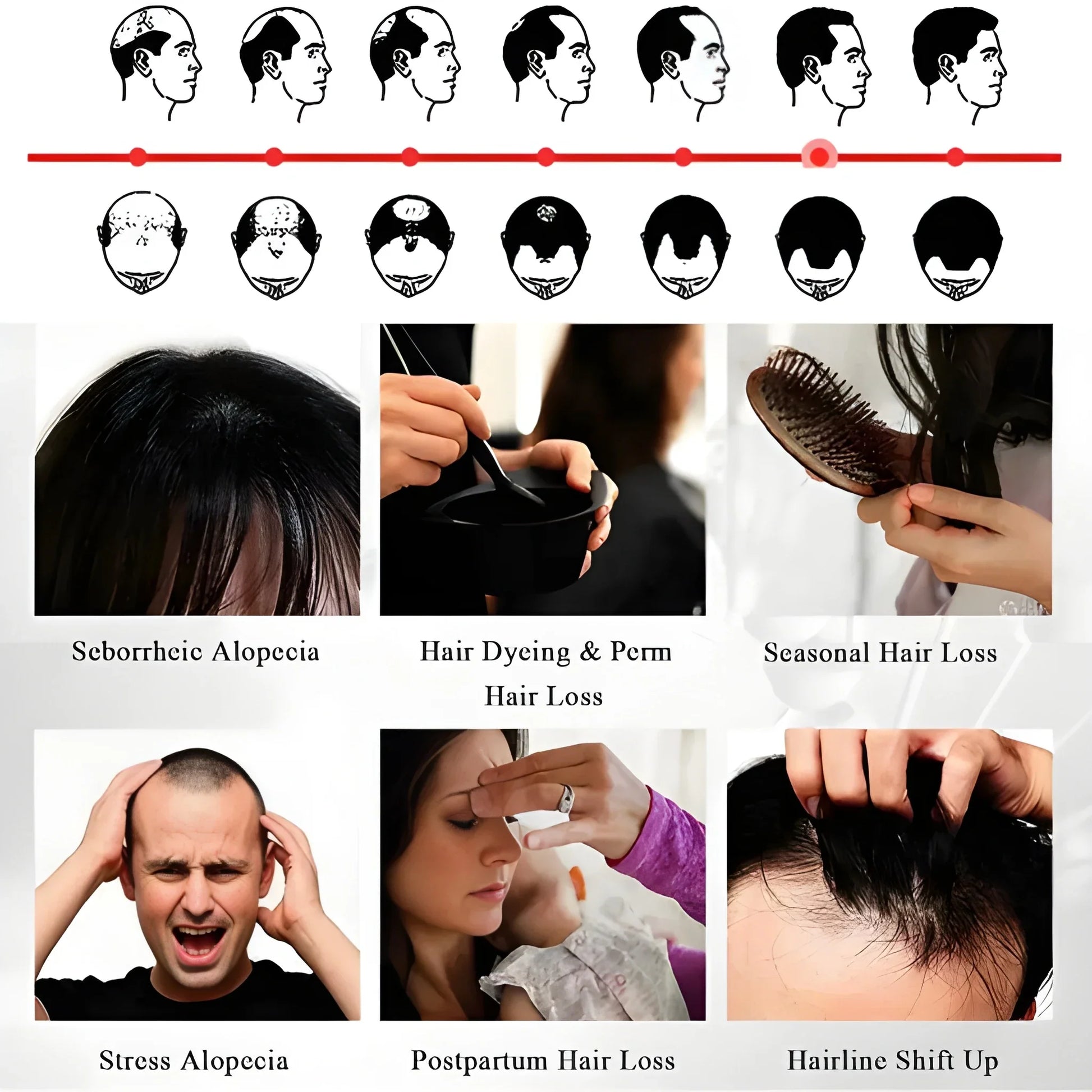 Anti Hair Loss Growth Spray