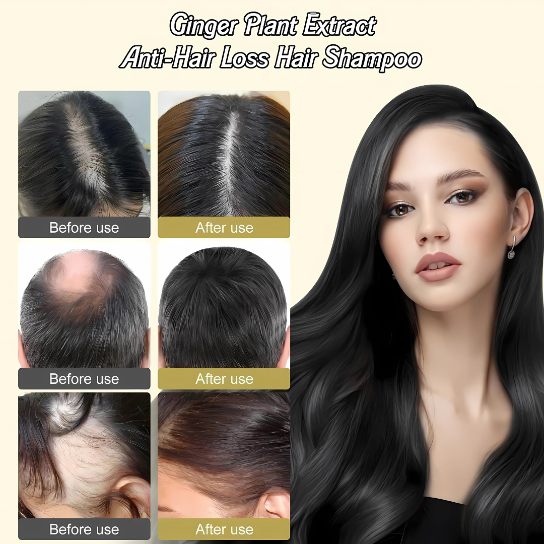 Anti Hair Loss Hair Shampoo 600 ml Pack of 3