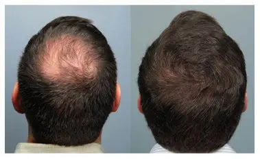 Aryusutra Herbal Hair Oil 100ml Hair Growth Serum