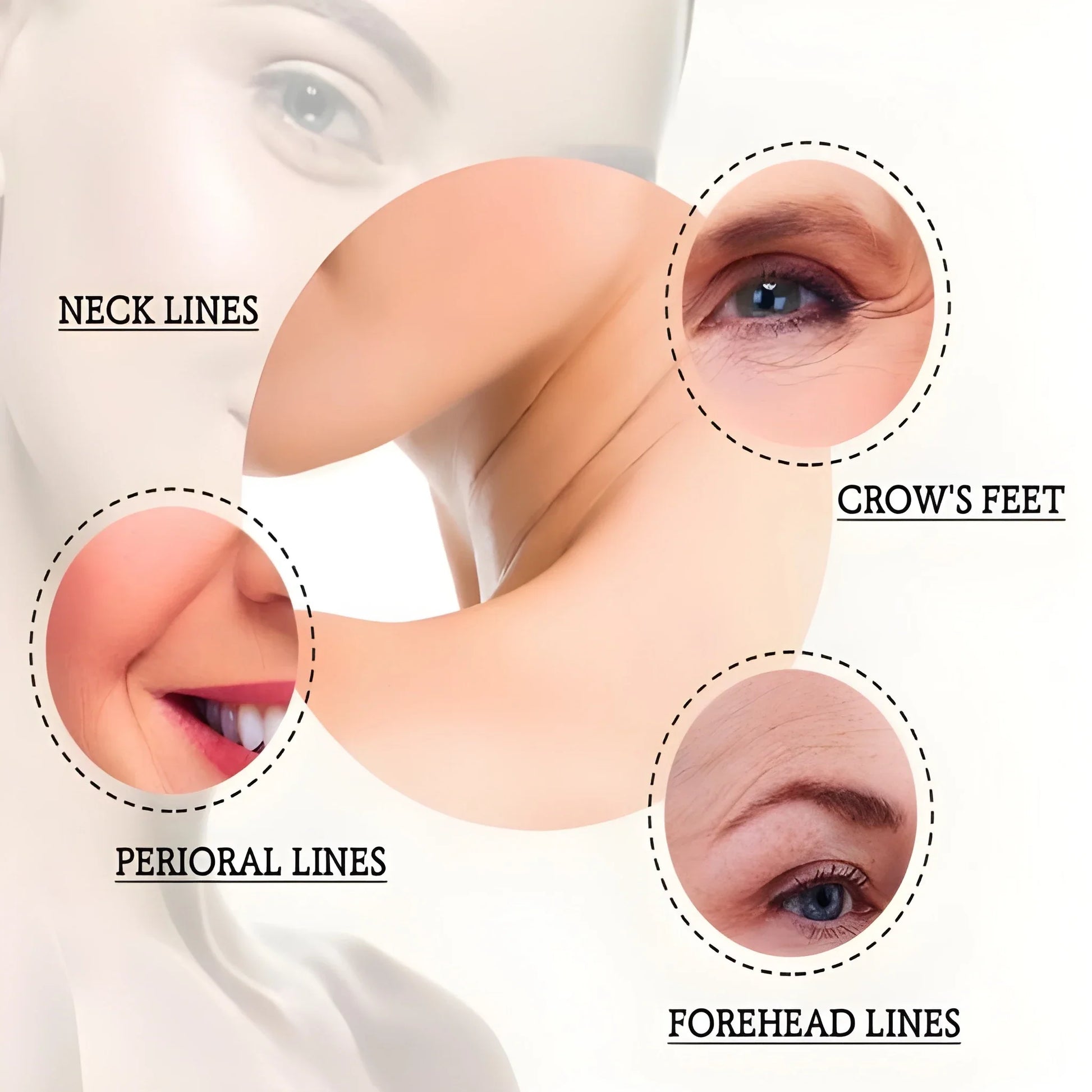 Botox Like Wrinkle Treatment