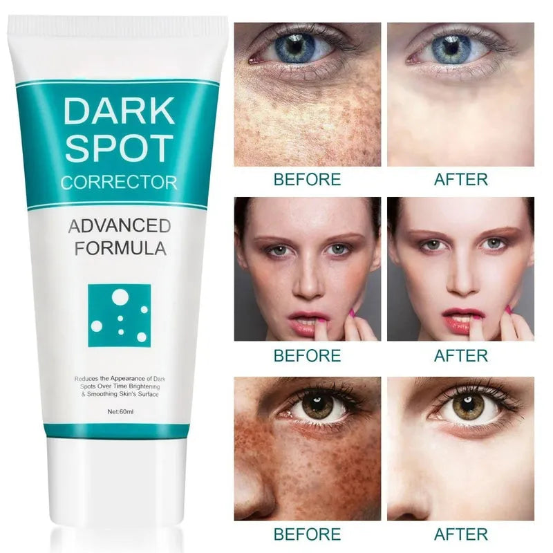 Dark Spot Corrector For Face 60 ml face serum