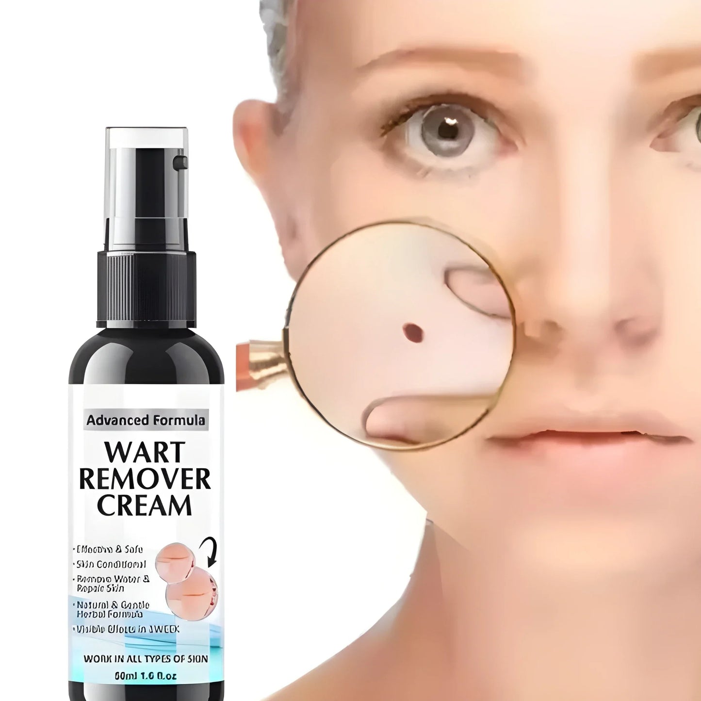 Fezora Wart Remover Cream – Pack of 2