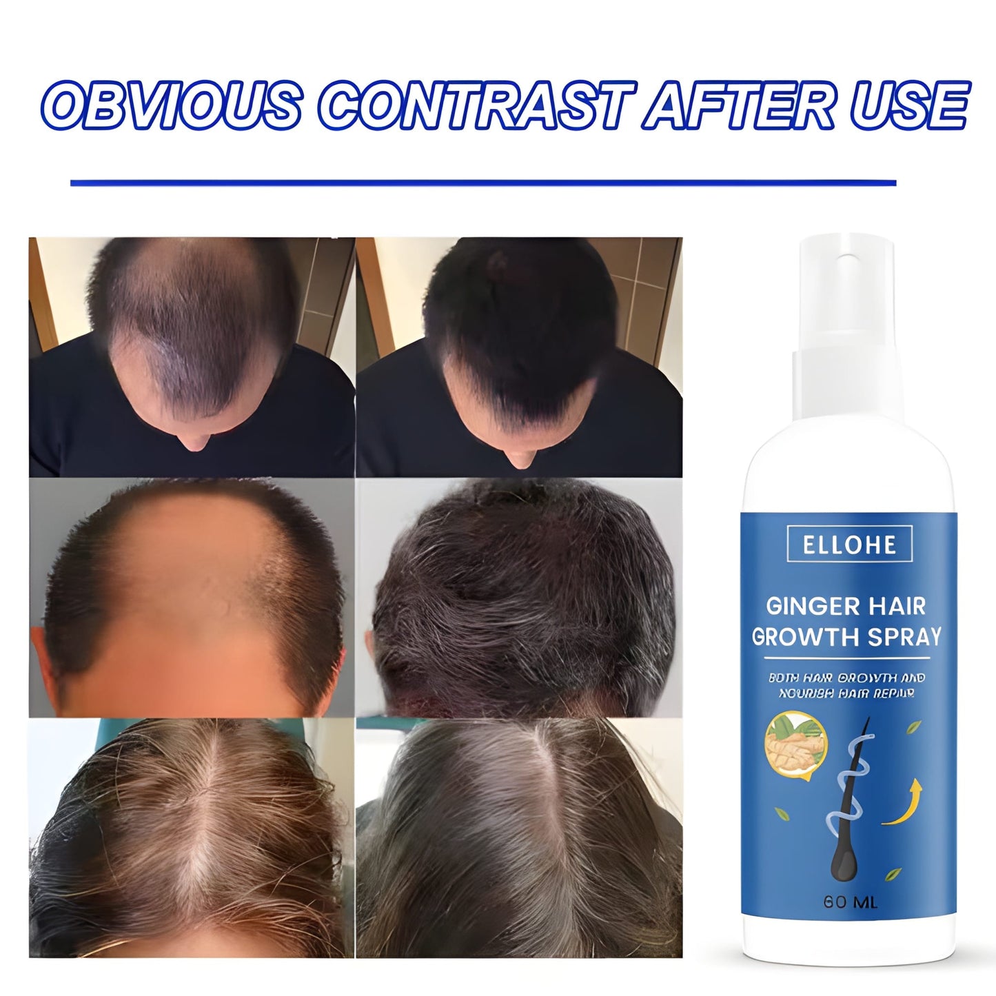 Ginger Hair Growth Spray