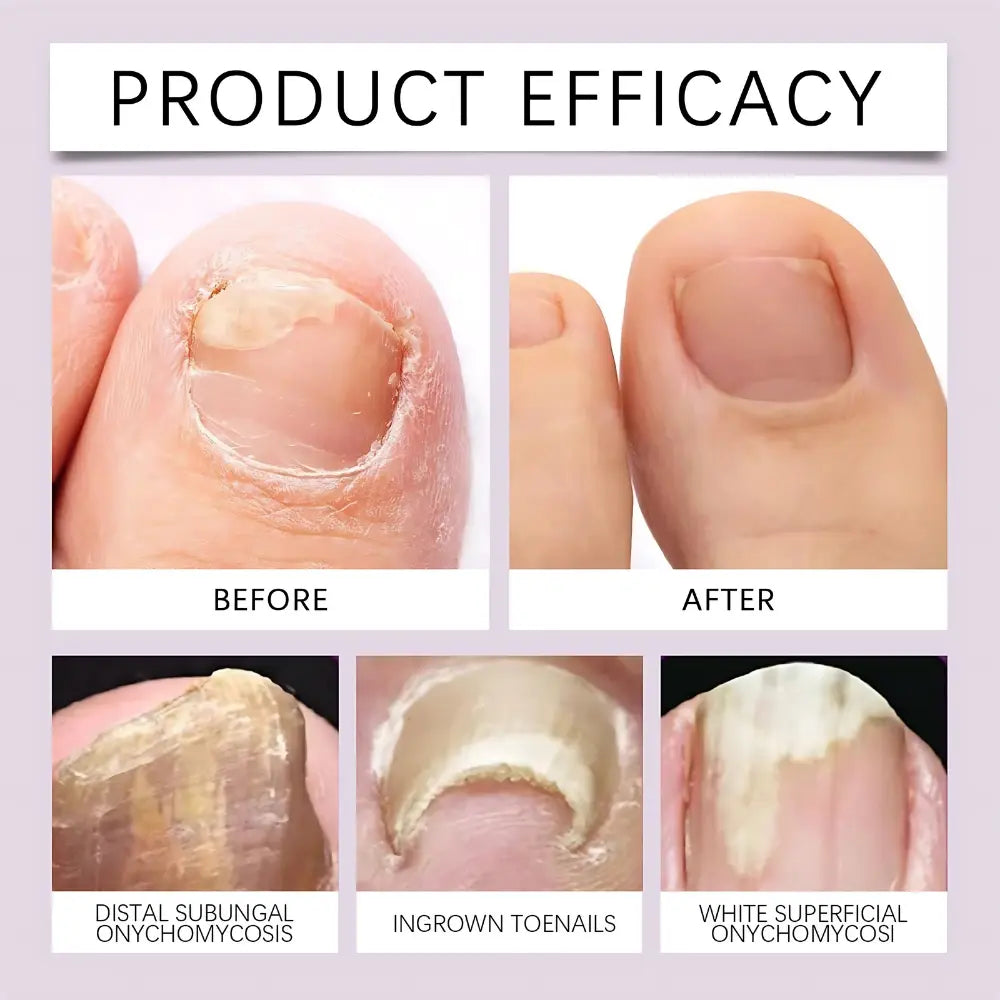 Bee Venom Nail Renewal Serum