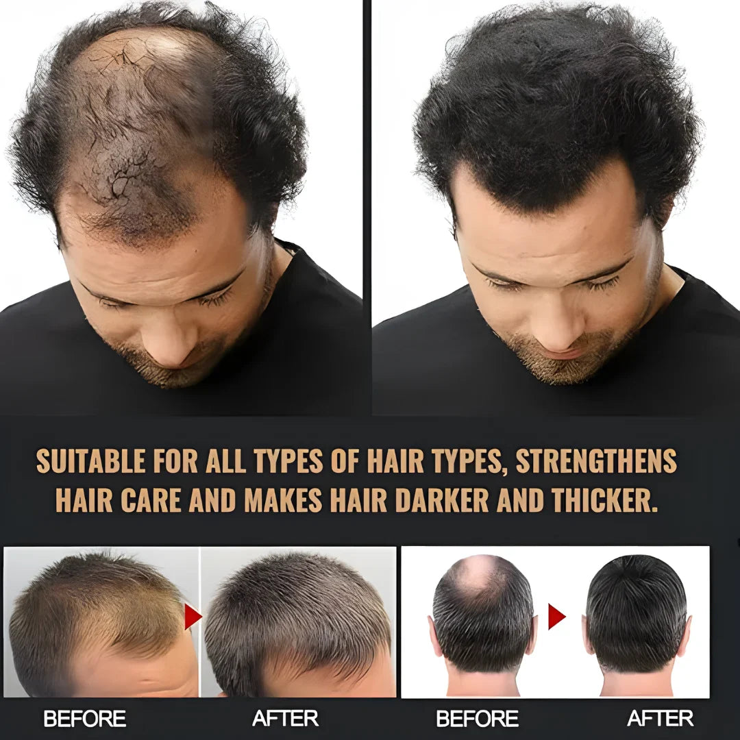 Root Activating Shampoo 200 ml Pack of 2