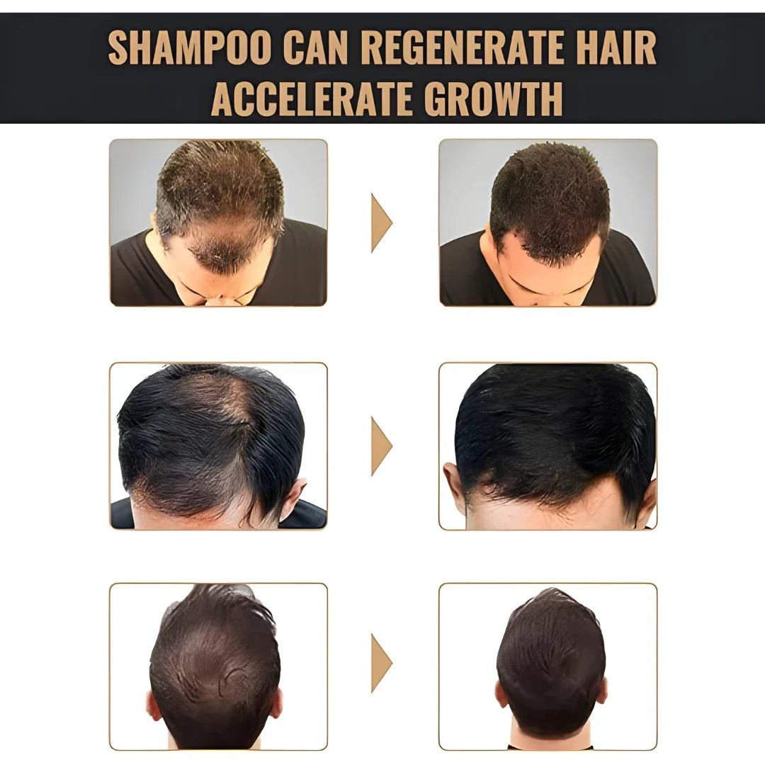 Root Activating Shampoo 200 ml Pack of 2