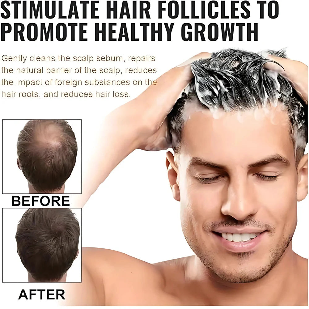 Root Stimulating Hair Shampoo