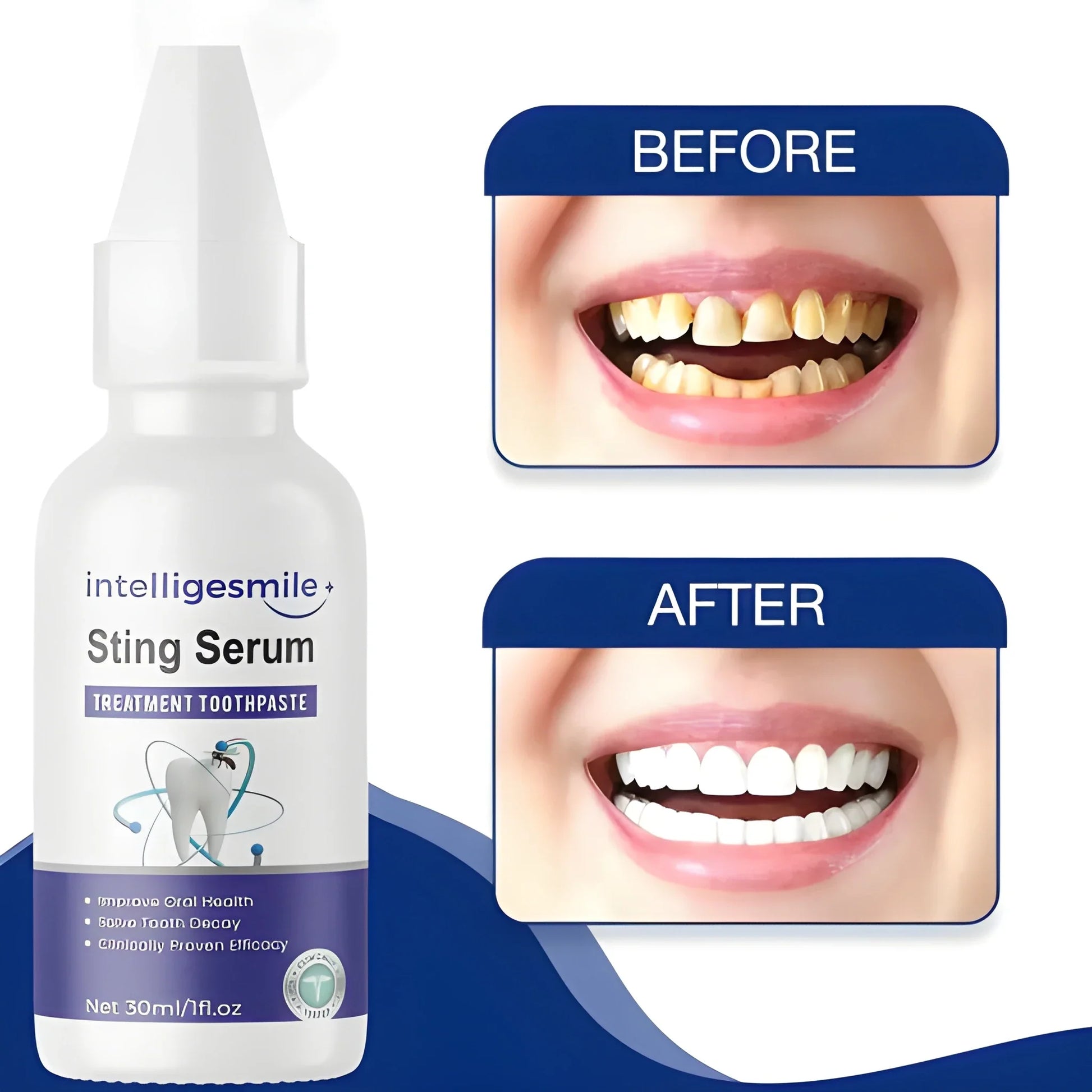Sting Serum Whitening Toothpaste