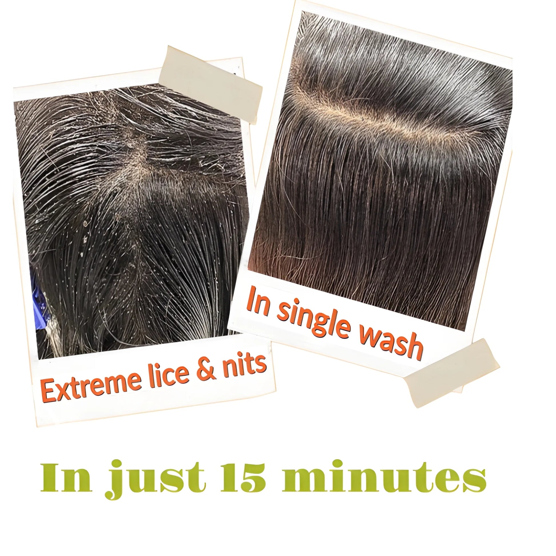 Tea Tree Lice Shampoo