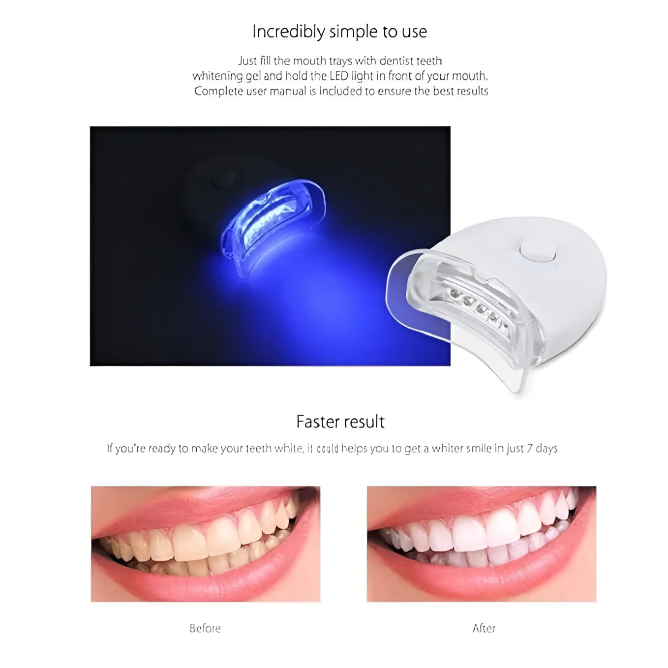Teeth Cleaning & Whitening Kit Health