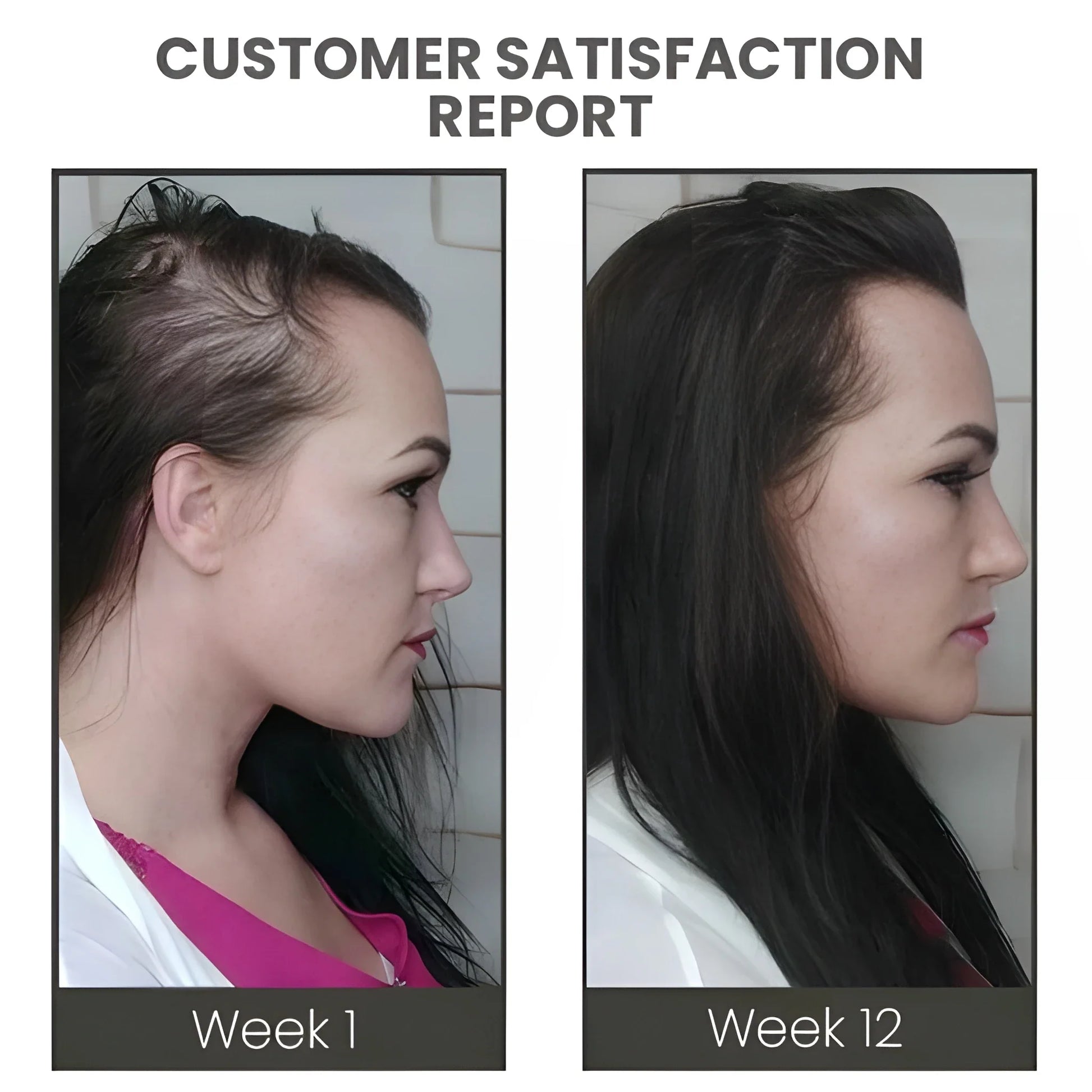 Thickening Hair Growth Spray