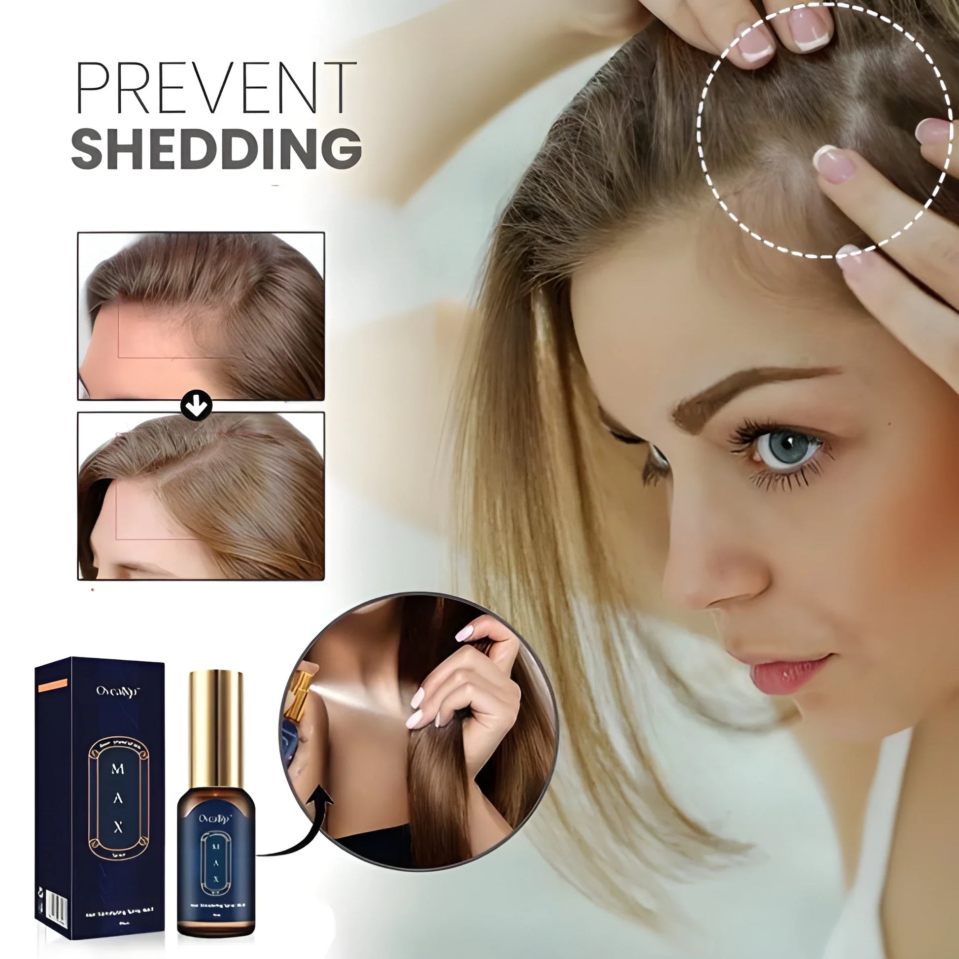 Thickening Hair Growth Spray