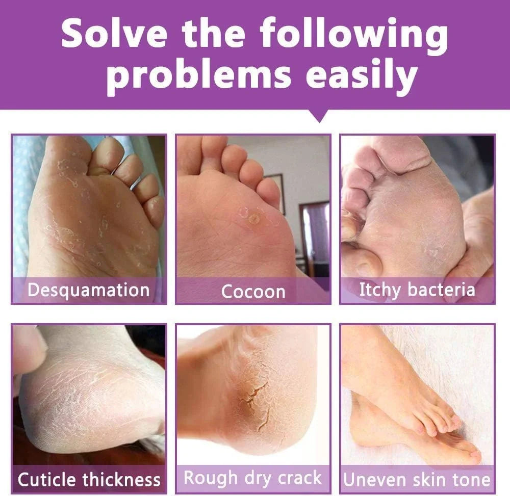 Vitamin C Foot Mask beauty care