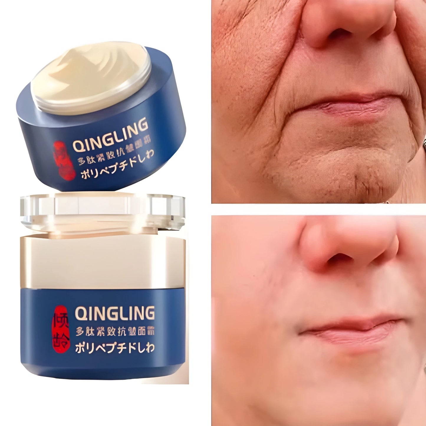 Retinol Wrinkle Removal Cream