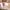 Vacuum Massage Cups – Face & Body