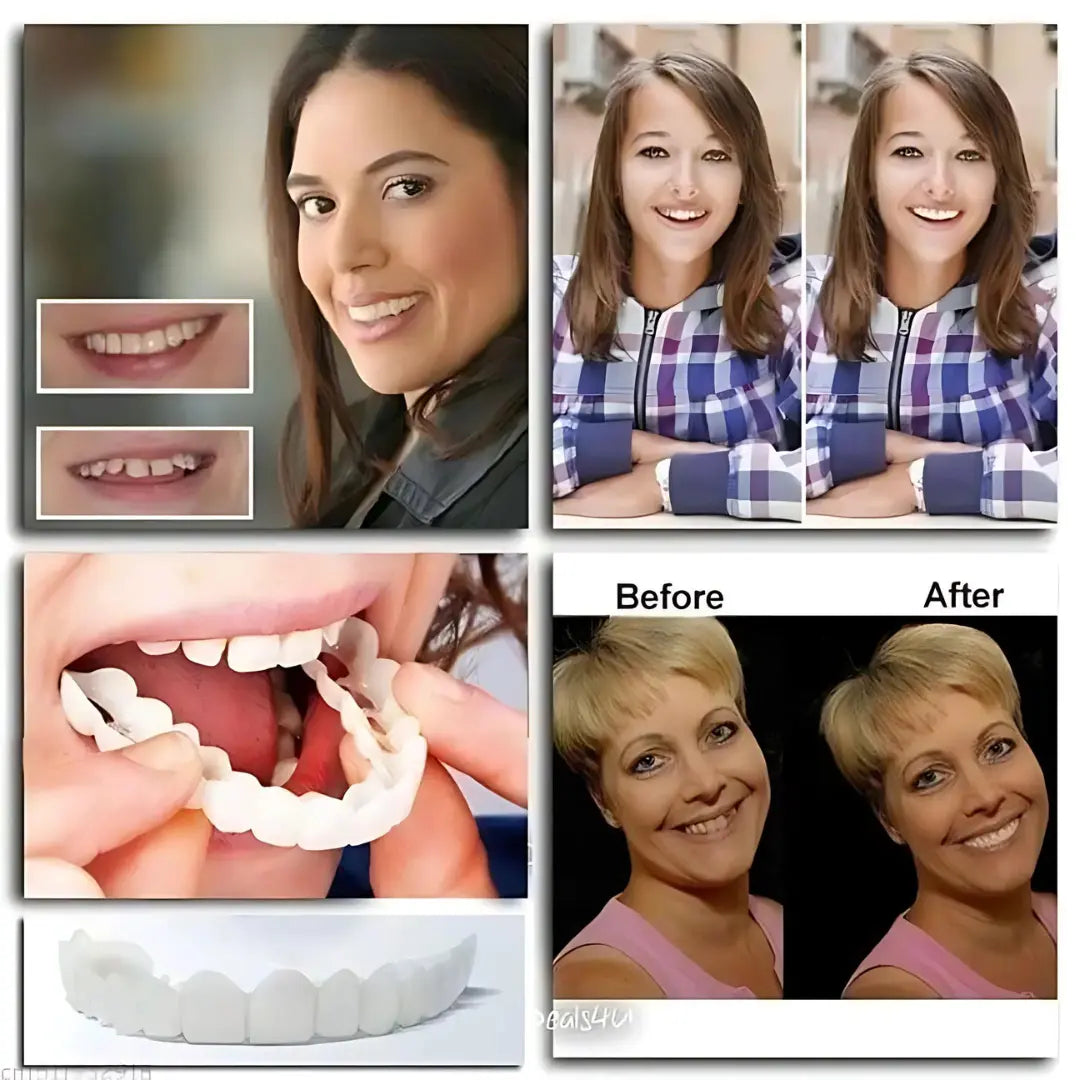 Fit Flex Cosmetic Teeth Denture