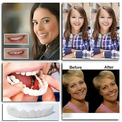 Fit Flex Cosmetic Teeth Denture