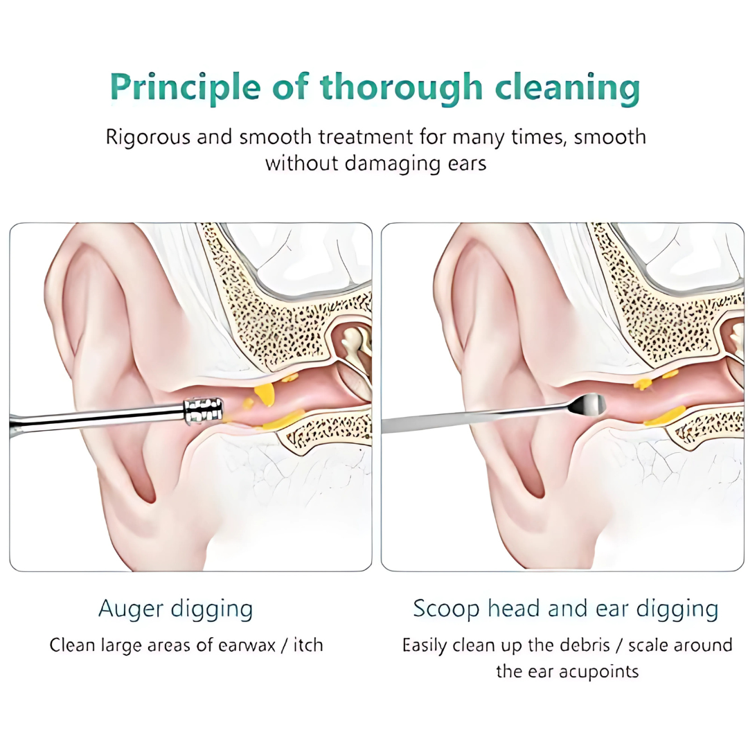 6 Pieces Ear Wax Removal Smooth Stainless Steel Kit