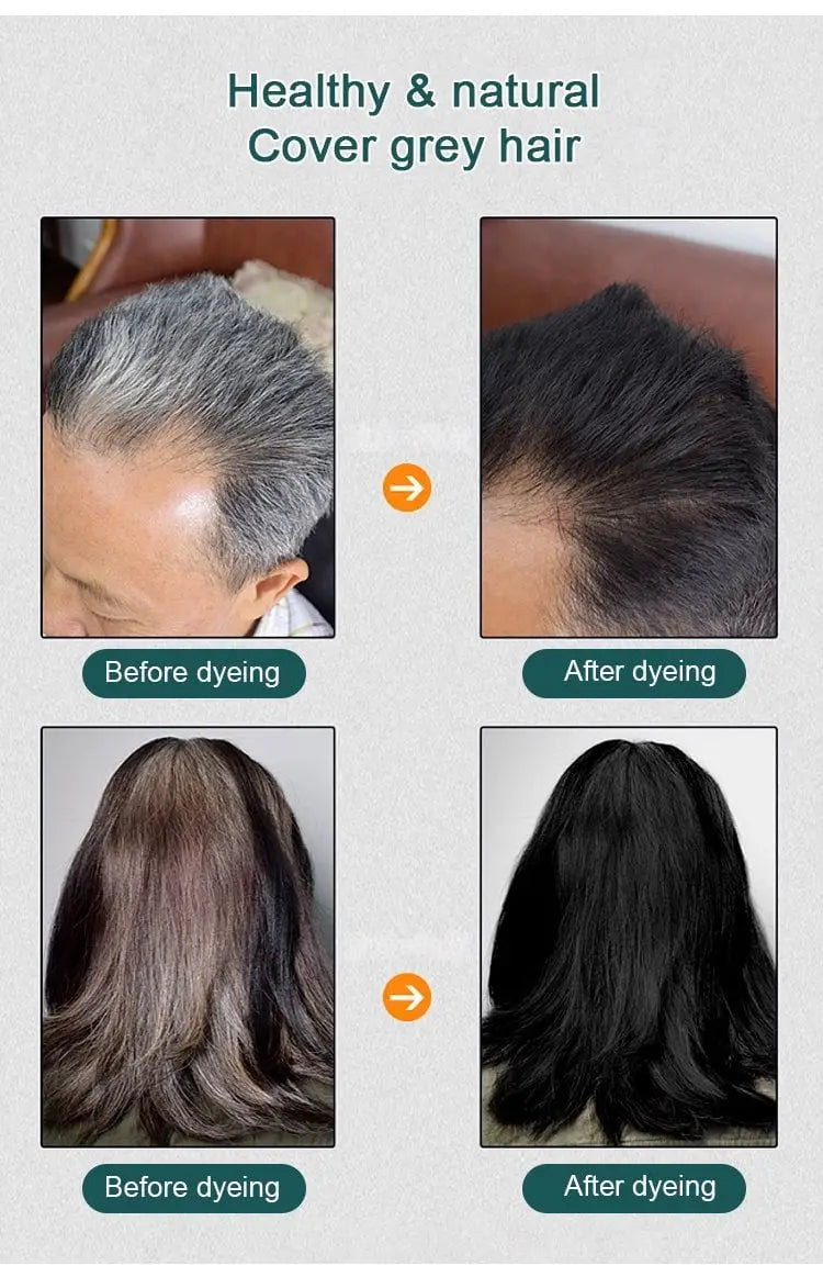 3 in 1 Black Hair Shampoo (Buy 1 Get 1 Free)