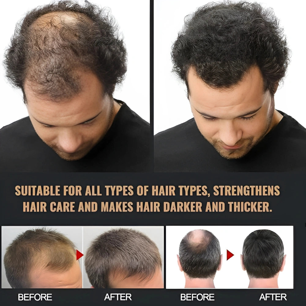 Root Stimulating Hair Shampoo