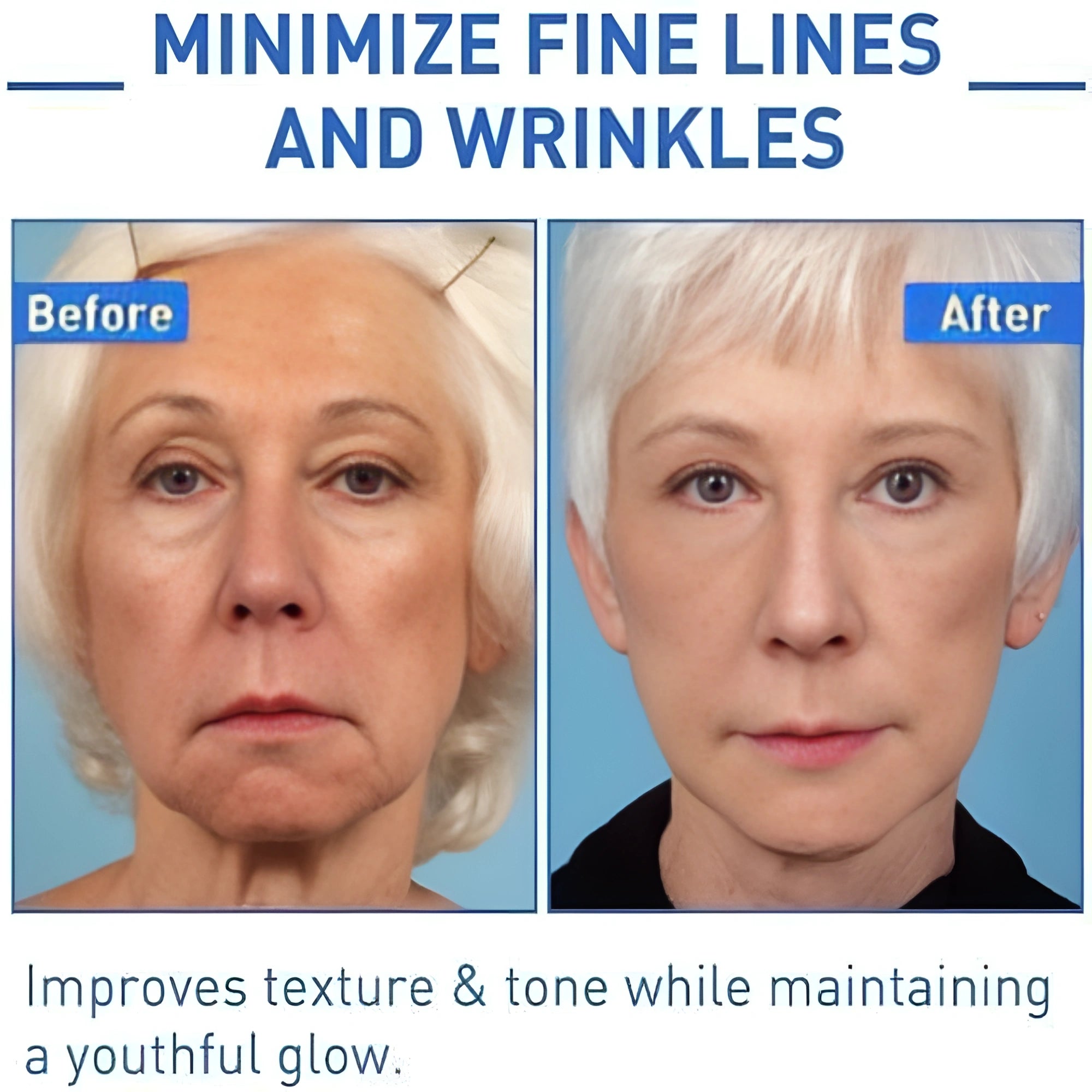 Youthful Botox Serum