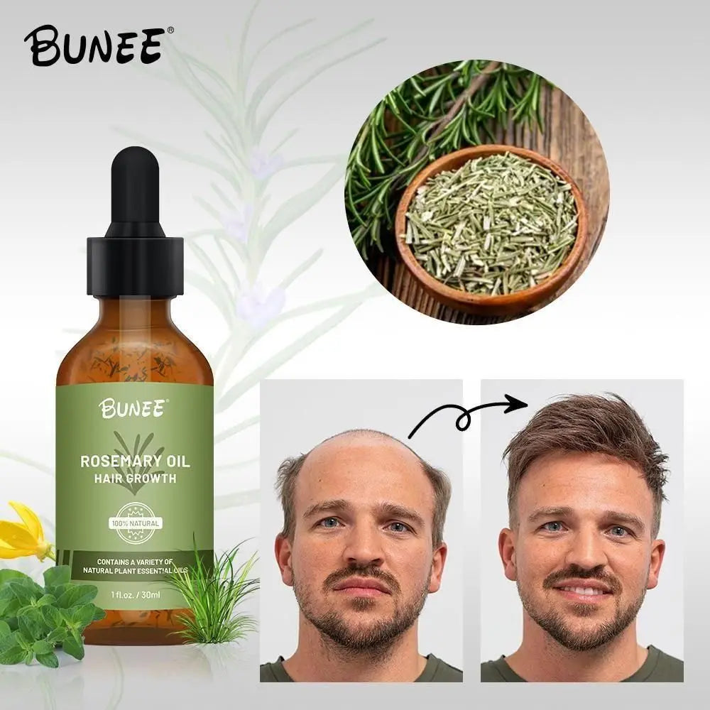 Rosemary Hair Oil Serum – 30ml