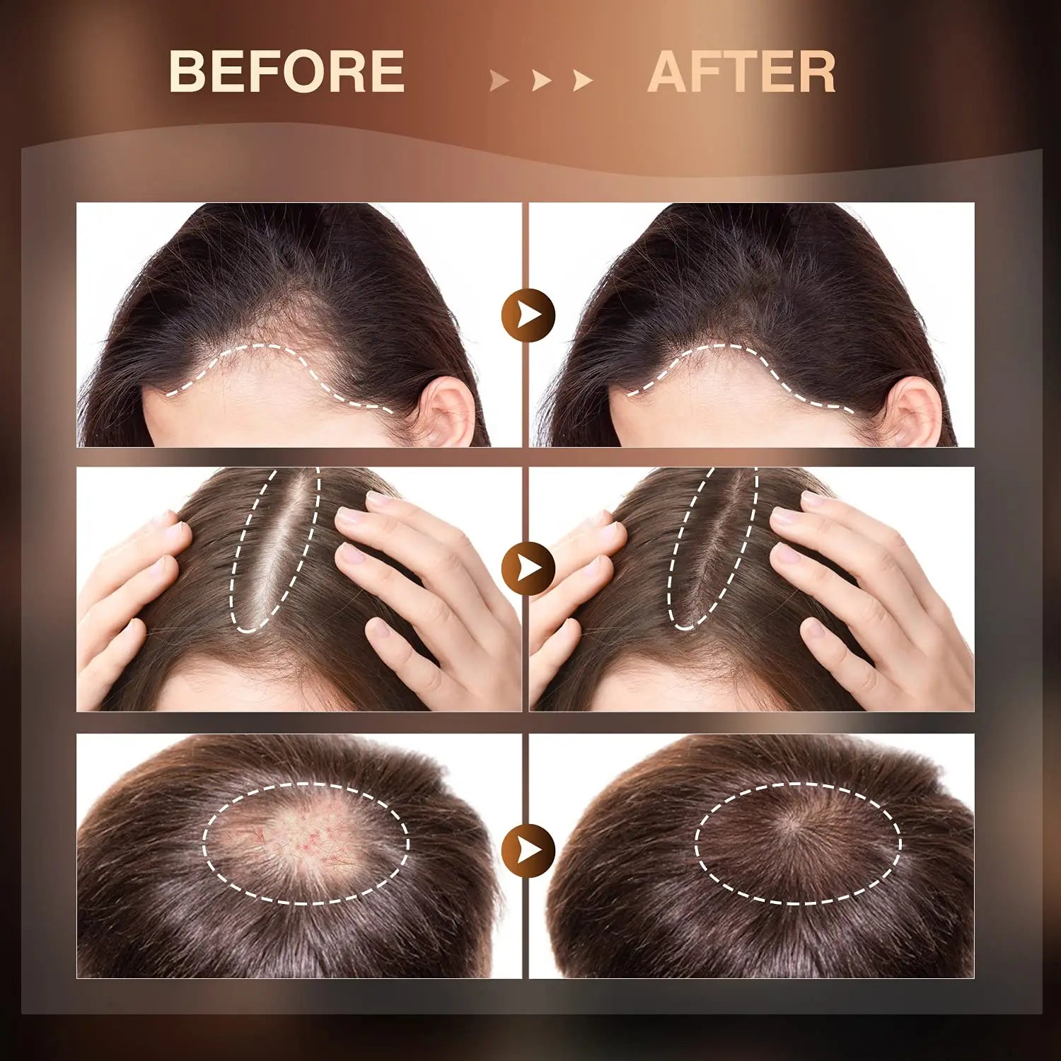 Hair Growth Oil With Biotin And Castor 30 ML (Pack Of 2)