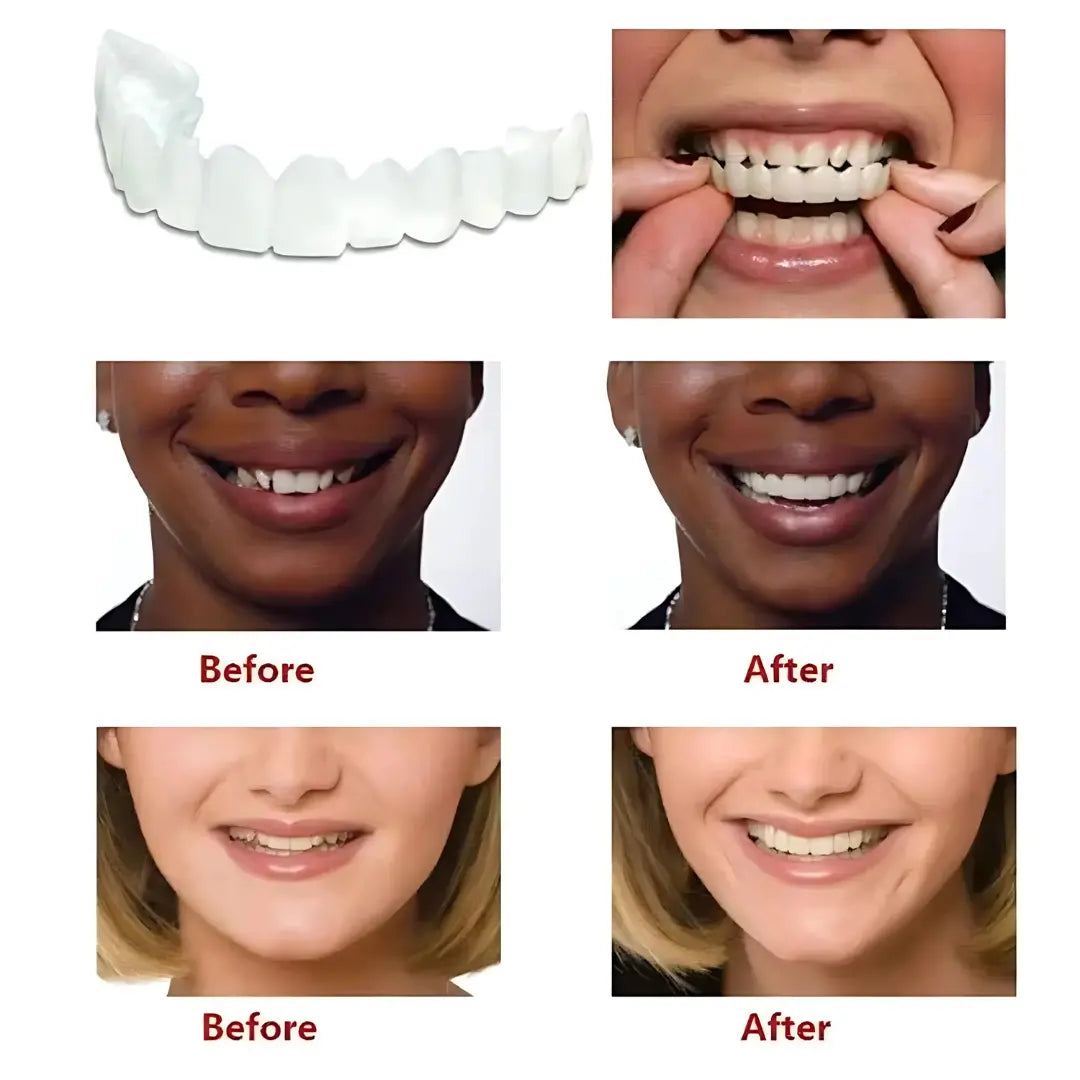 Fit Flex Cosmetic Teeth Denture