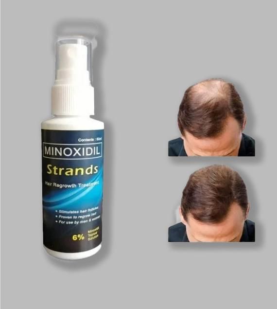 Minoxidil Topical Solution for Men 60ml – MaxSmile