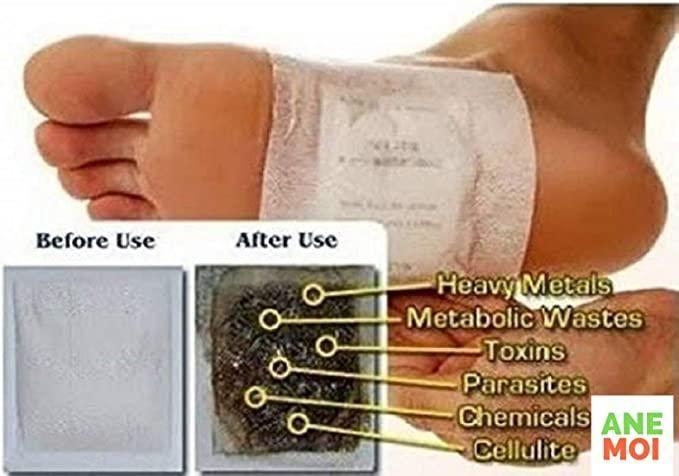 Detox Foot Patches  (Set of 10)