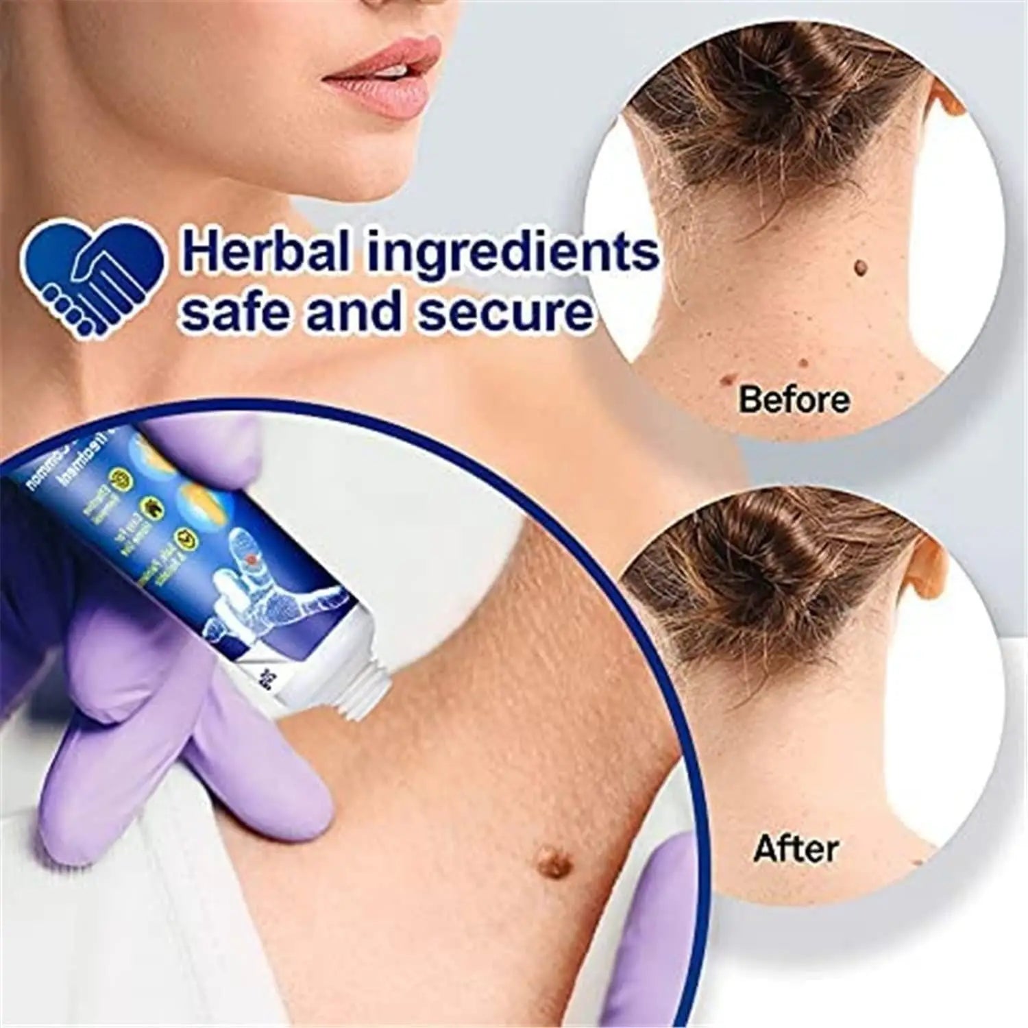 WartsOff Herbal Skin Care Cream Pack of 2