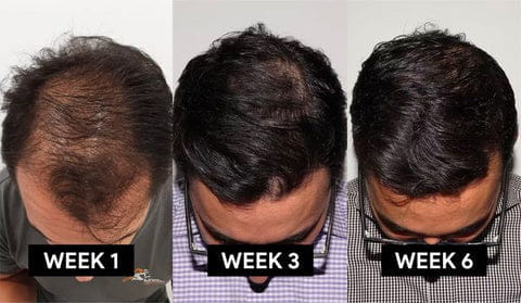 Saikachi Hair Herbal Shampoo