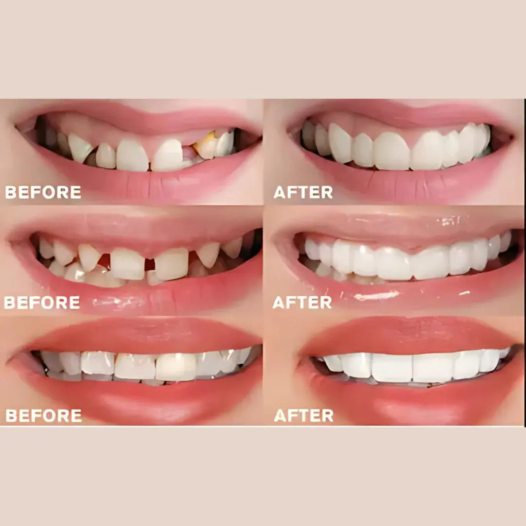 Fit Flex Cosmetic Teeth Denture