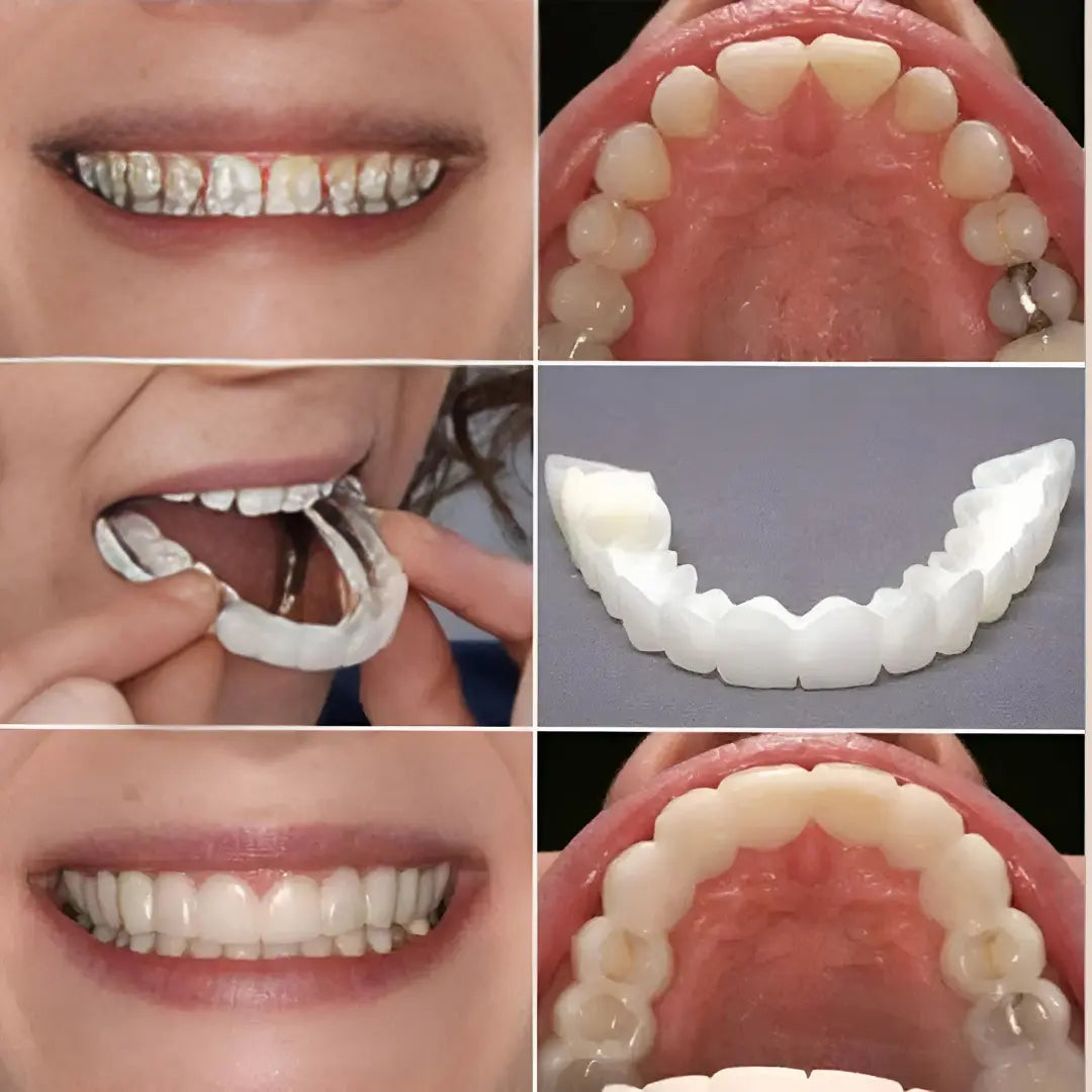 Fit Flex Cosmetic Teeth Denture