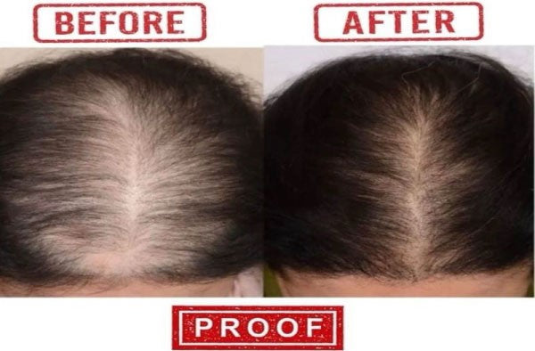 Adivasi Jeeva Sanjivani Herbal Hair Oil  (Pack of 2)