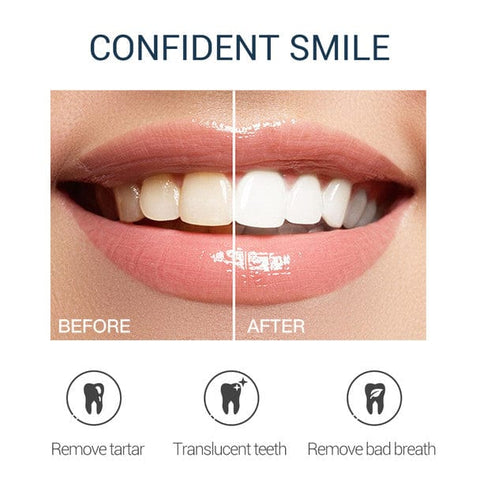 Dentiqo Whitening