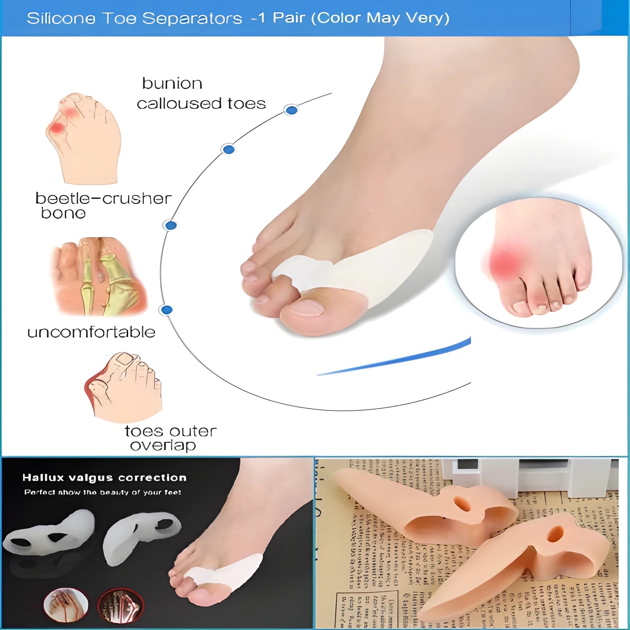 Bunion Relief Separators