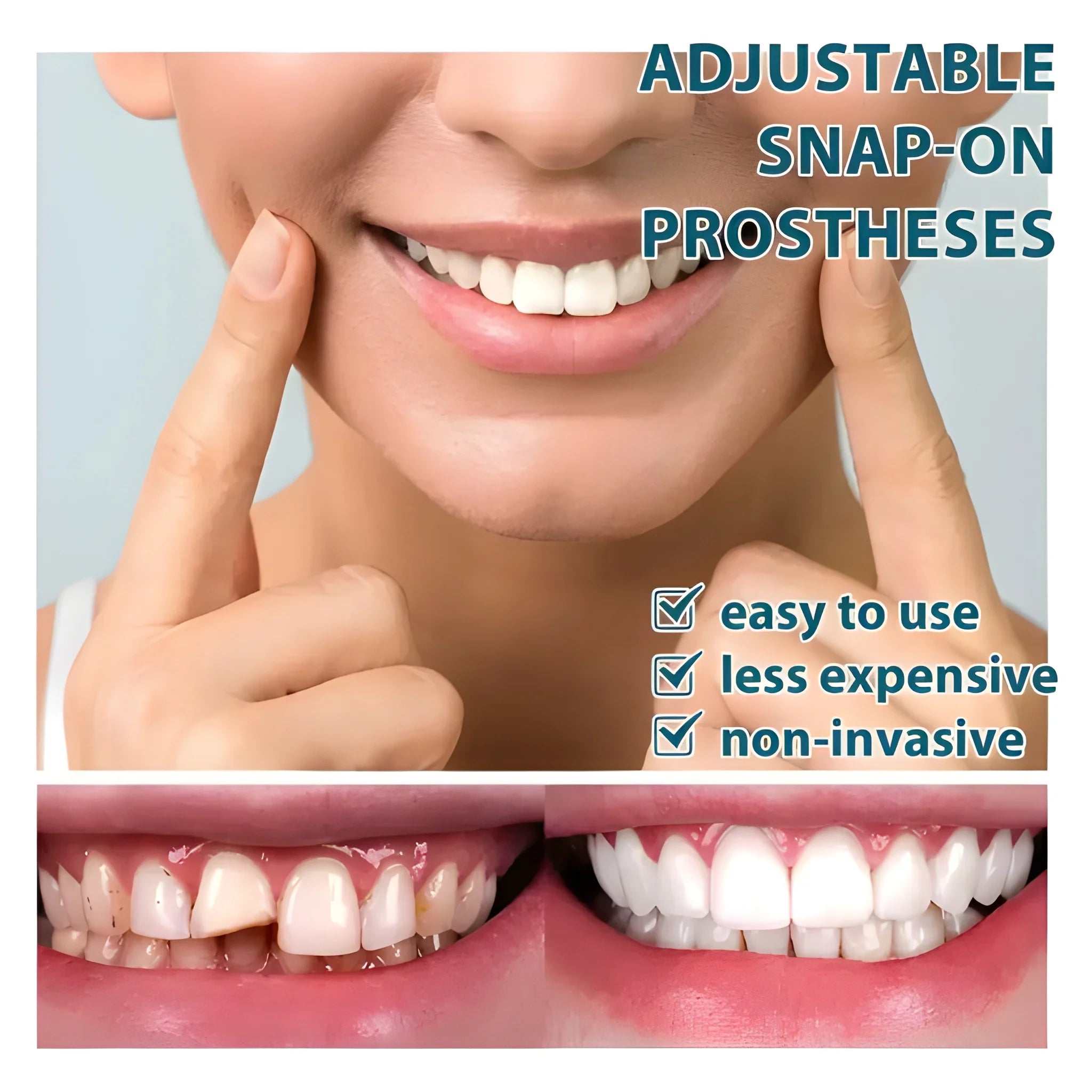 Instant Smile Veneers