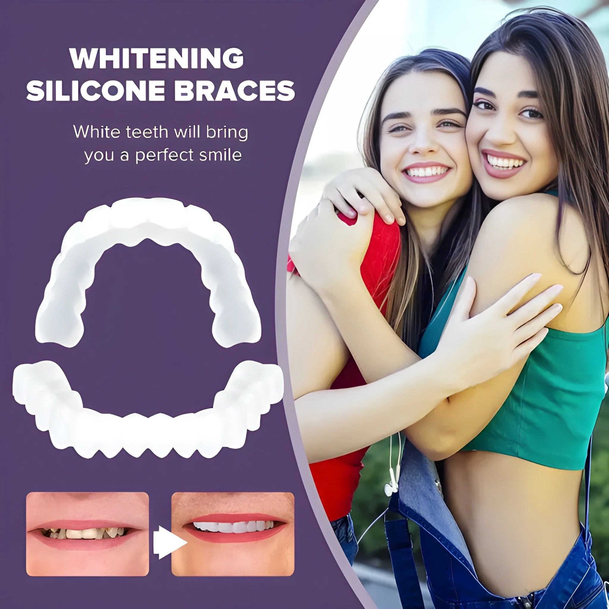 Instant Smile Veneers
